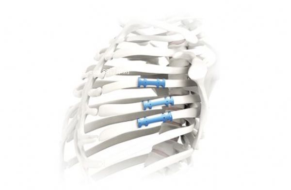 �N���߹ǰ� �߹ǰ�S�ҏV�|��(b��o)�r(ji��)