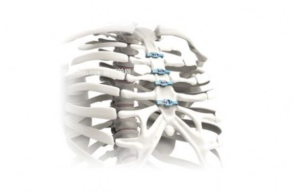 �عǰ�̶��� H�� ���� �S���N(xi��o)��