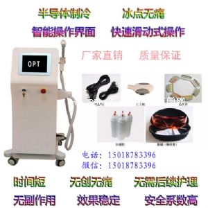 OPT���c(di��n)�oʹÓë�x