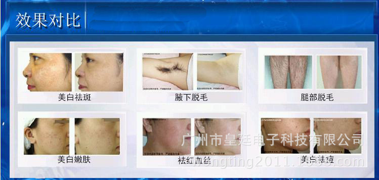 ��(sh��)��2