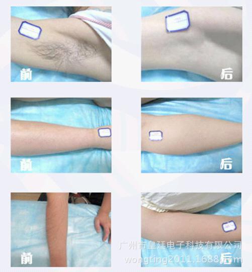 ��(sh��)��4